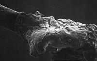 Hair root